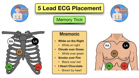 5 lead ekg placement.